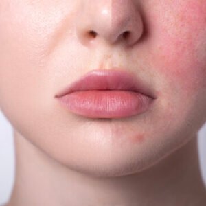Sensitive Skin