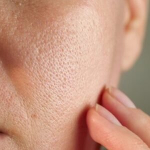 Combination skin