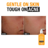 Neutrogena Oil Free Acne Wash