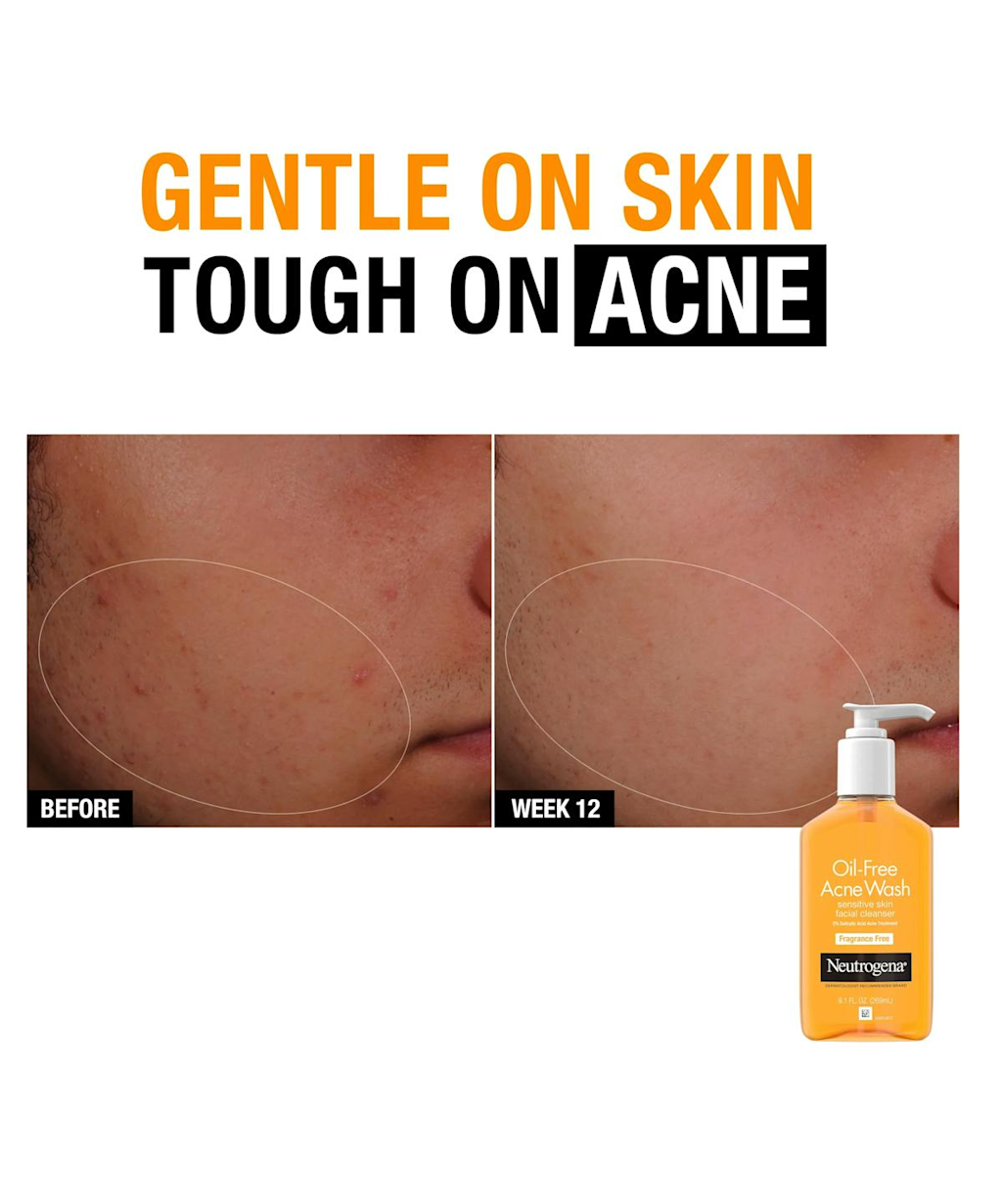 Neutrogena Oil Free Acne Wash