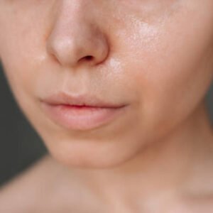 Oily skin