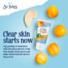 St.Ives Blemish Control Apricot Facial Scrub (150ml)